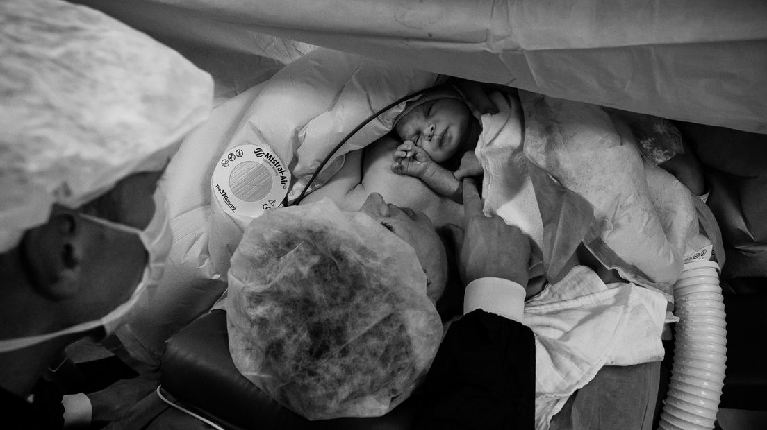 Een foto van een geboorte door middel van een keizersnede