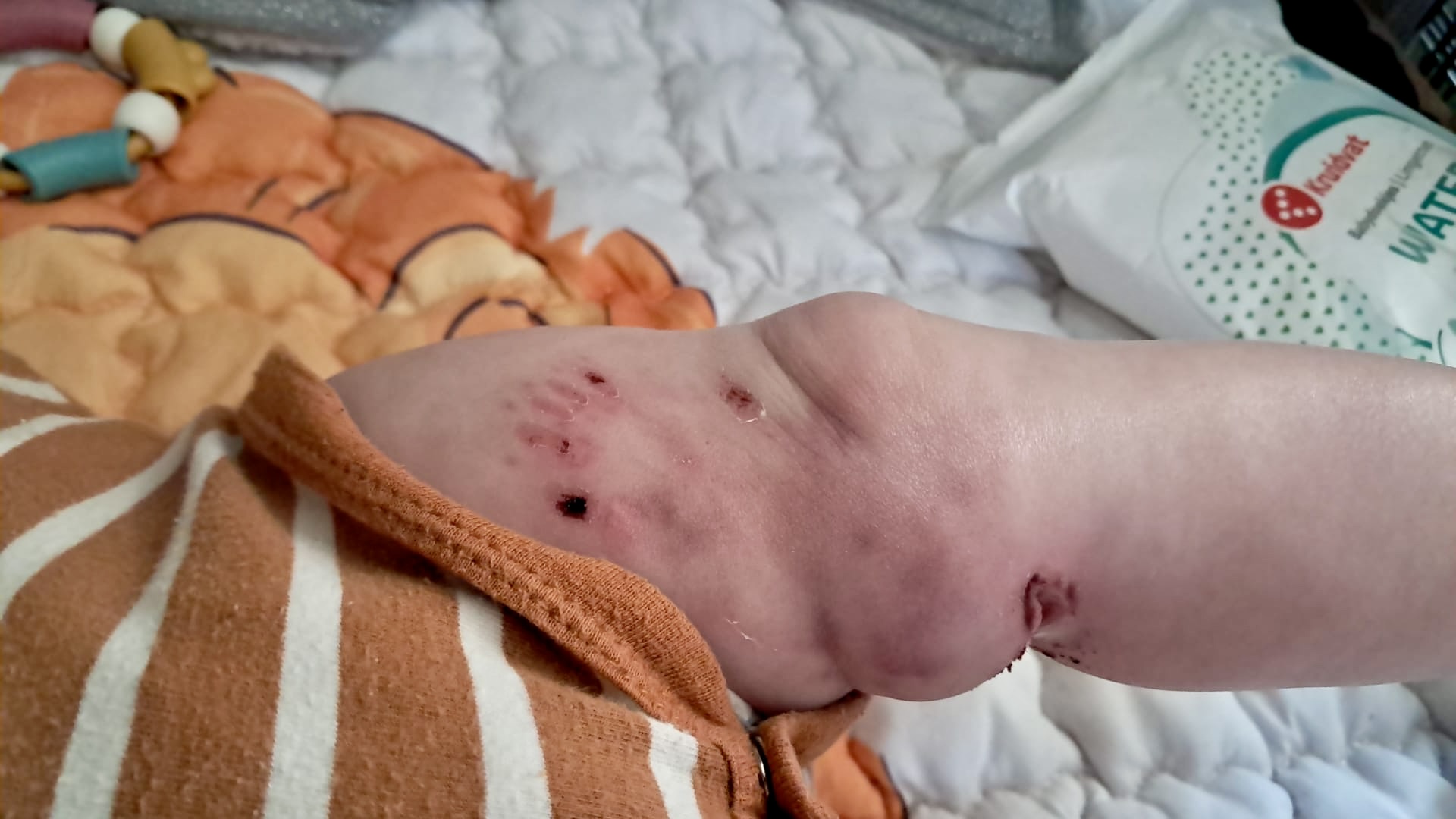 Onrust in Coevorder wijk nadat baby is gebeten door herdershond: 'Zwartste dag van mijn leven'