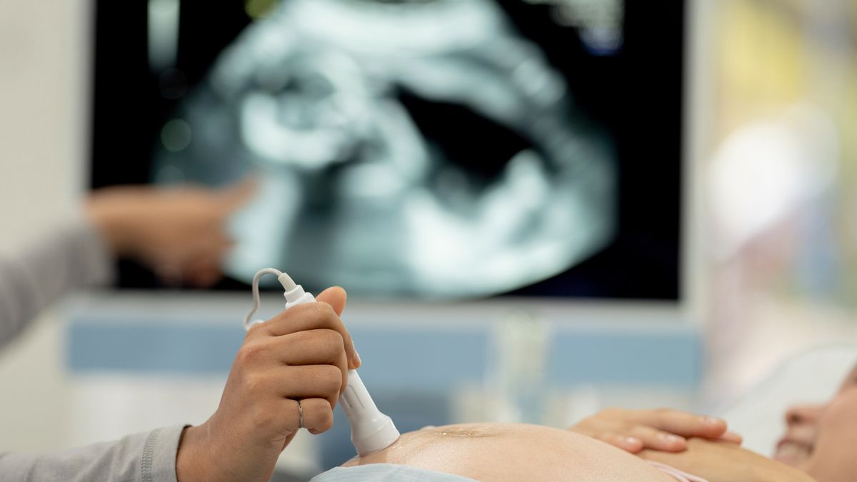 Geboortecentrum Zuyderland schaalt af: minder bedden door personeelstekort