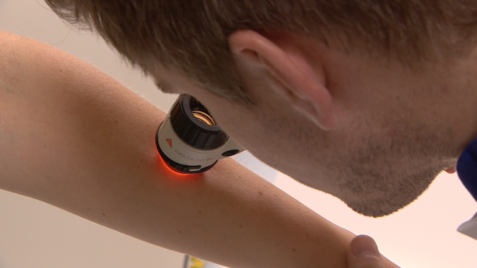 Adrz heeft twee waarnemers gevonden voor dermatologie en dat is hoognodig in het zonnige Zeeland