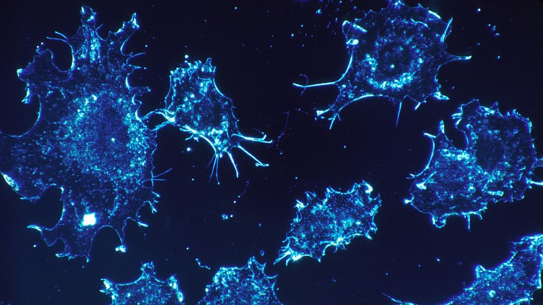 Dankzij immuuntherapie kan het afweersysteem kankercellen herkennen, opruimen en vernietigen