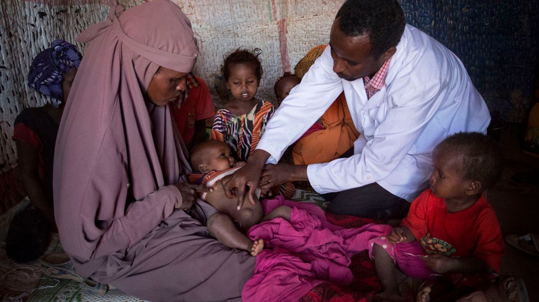 In Somalie zijn vele miljoenen mensen ernstig ondervoed.