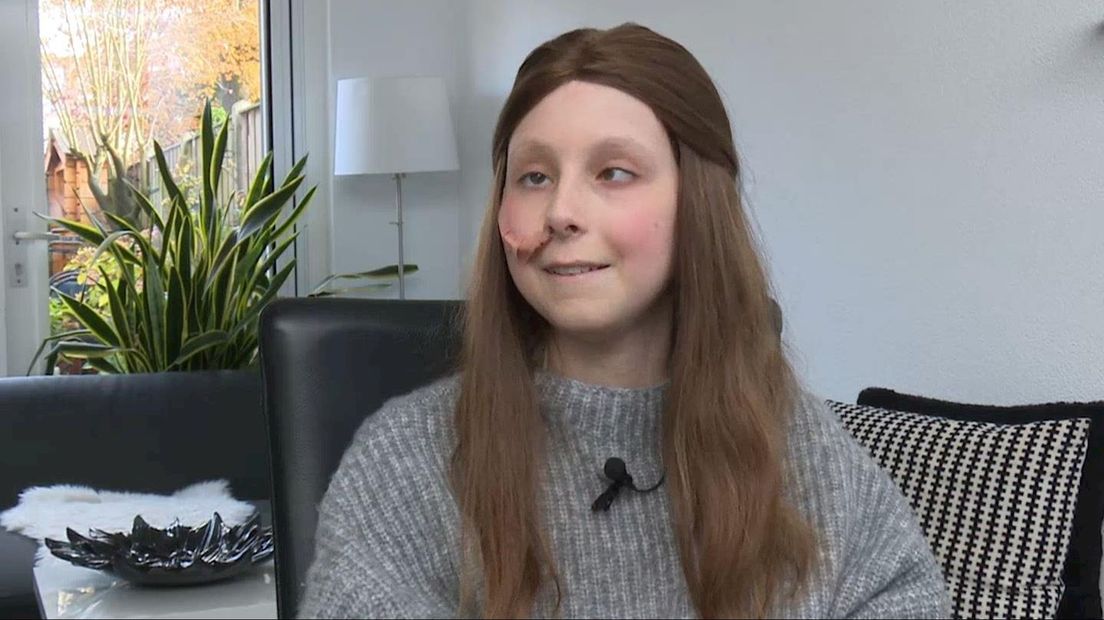 De 14-jarige Mynke verloor haar haar door een hersentumor