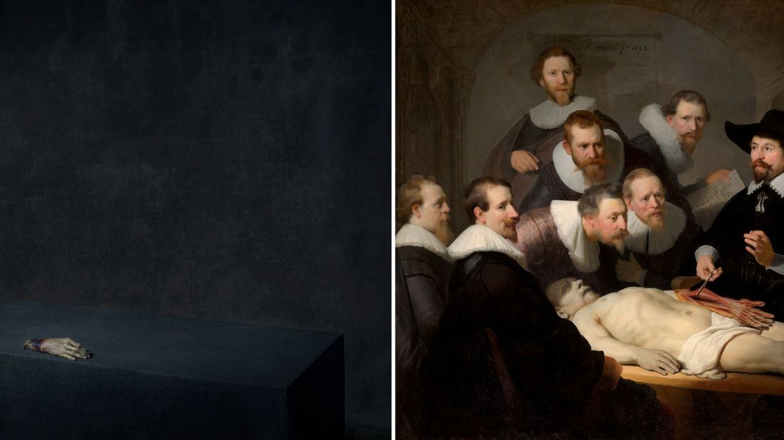 De anatomische les door Rembrandt en Vanfleteren