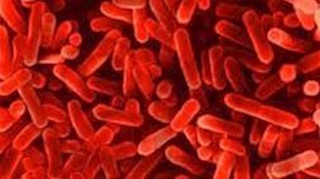 Legionella