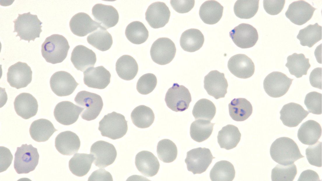 Het malariavaccin onder de microscoop