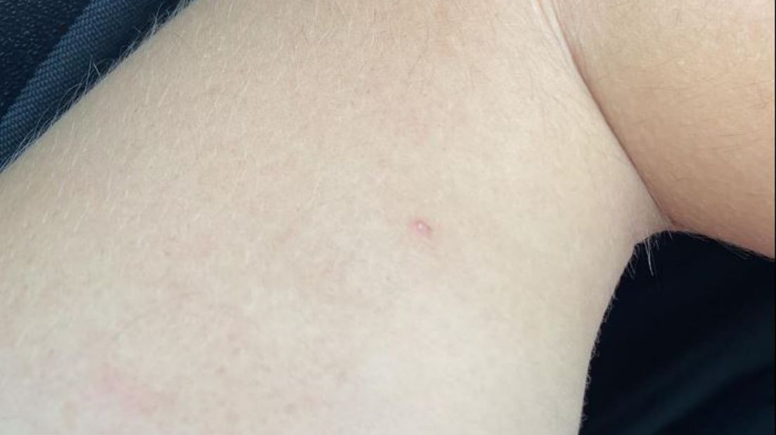 Het plekje op de arm van Jordy duidt mogelijk op een prikje van een naald