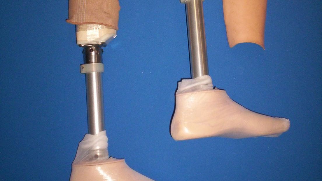 Onderbeen prothese