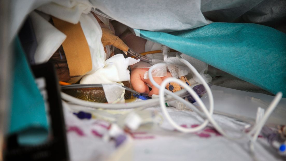 Een pasgeboren baby wordt geopereerd