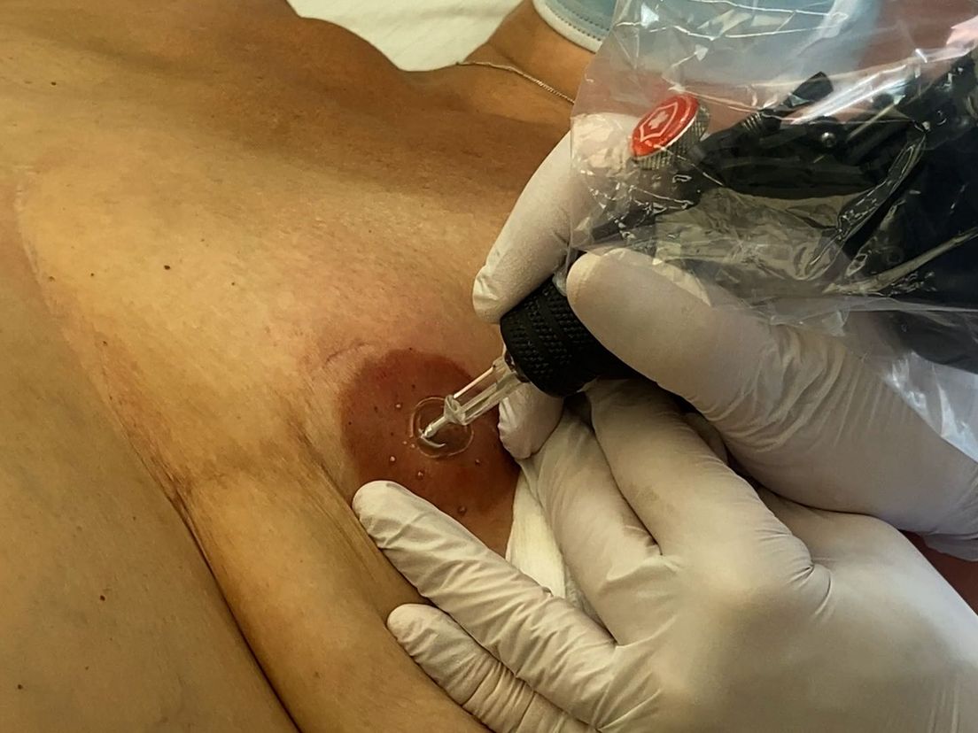 Deze getatoeëerde tepel is niet van echt te onderscheiden