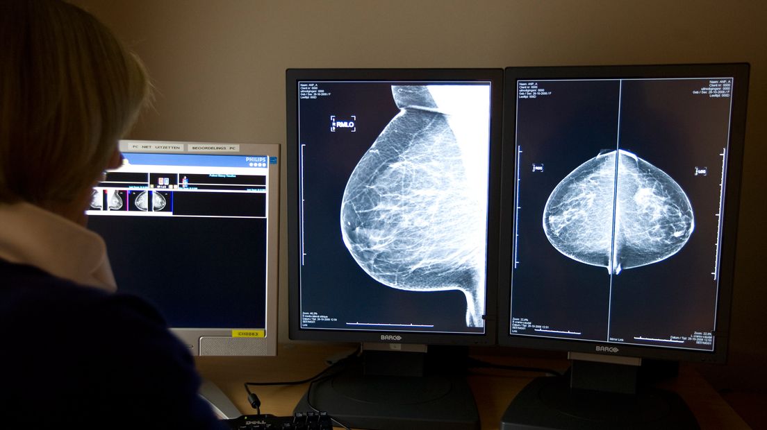 Een radioloog bekijkt röntgenfoto's bij borstkankeronderzoek.