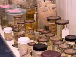 De collectie van de chirurg bestaat uit zo'n zeshonderd harten.