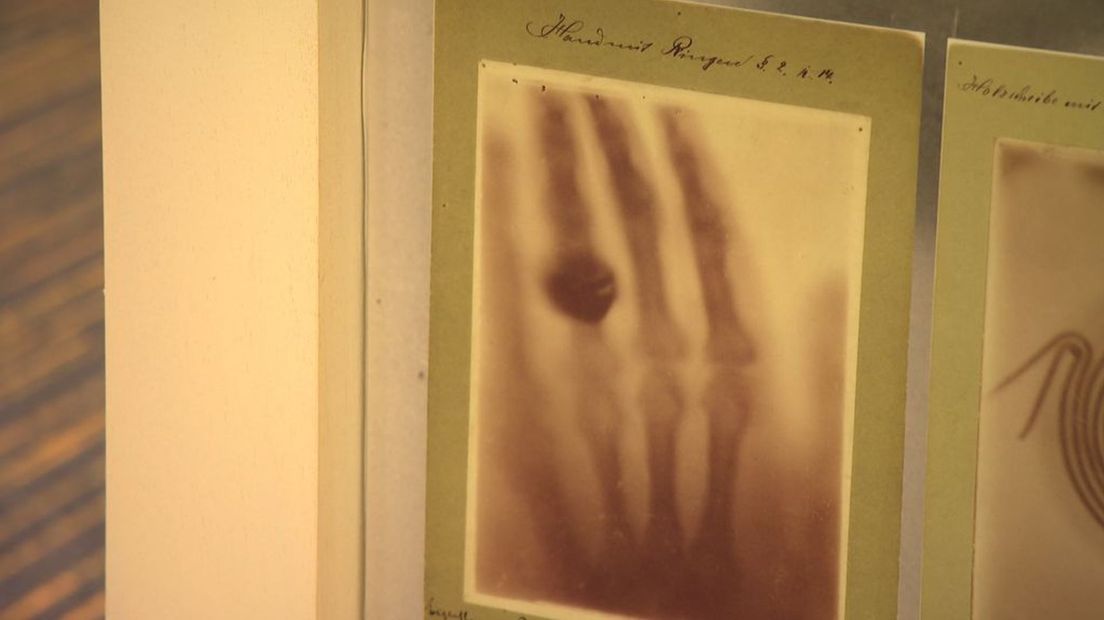 De allereerste röntgenfoto is te zien in de CODA-expositie.