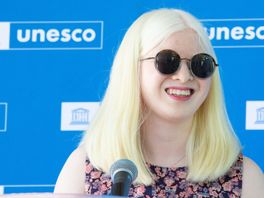 Xueli (17) heeft albinisme, is model én ambassadeur bij UNESCO: 'Iedereen moet geaccepteerd worden'