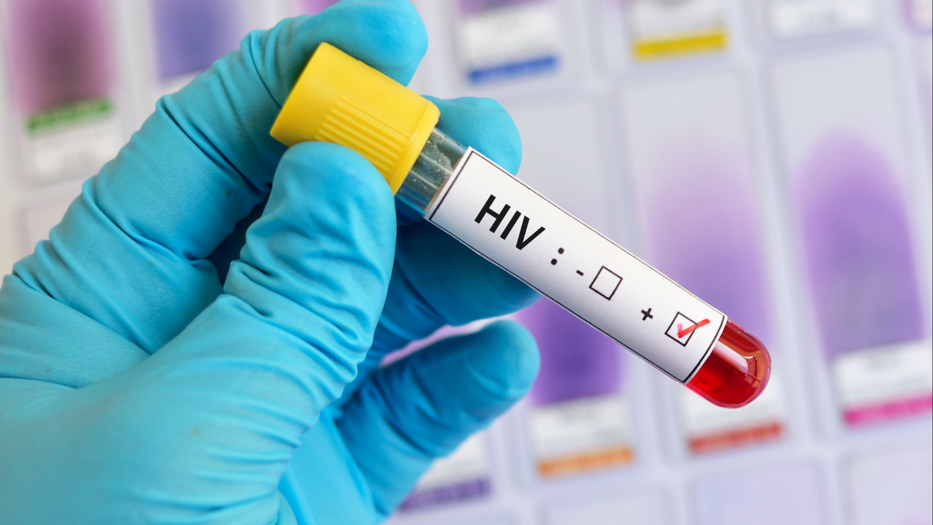 Het aantal hiv-besmettingen neemt toe in de regio.