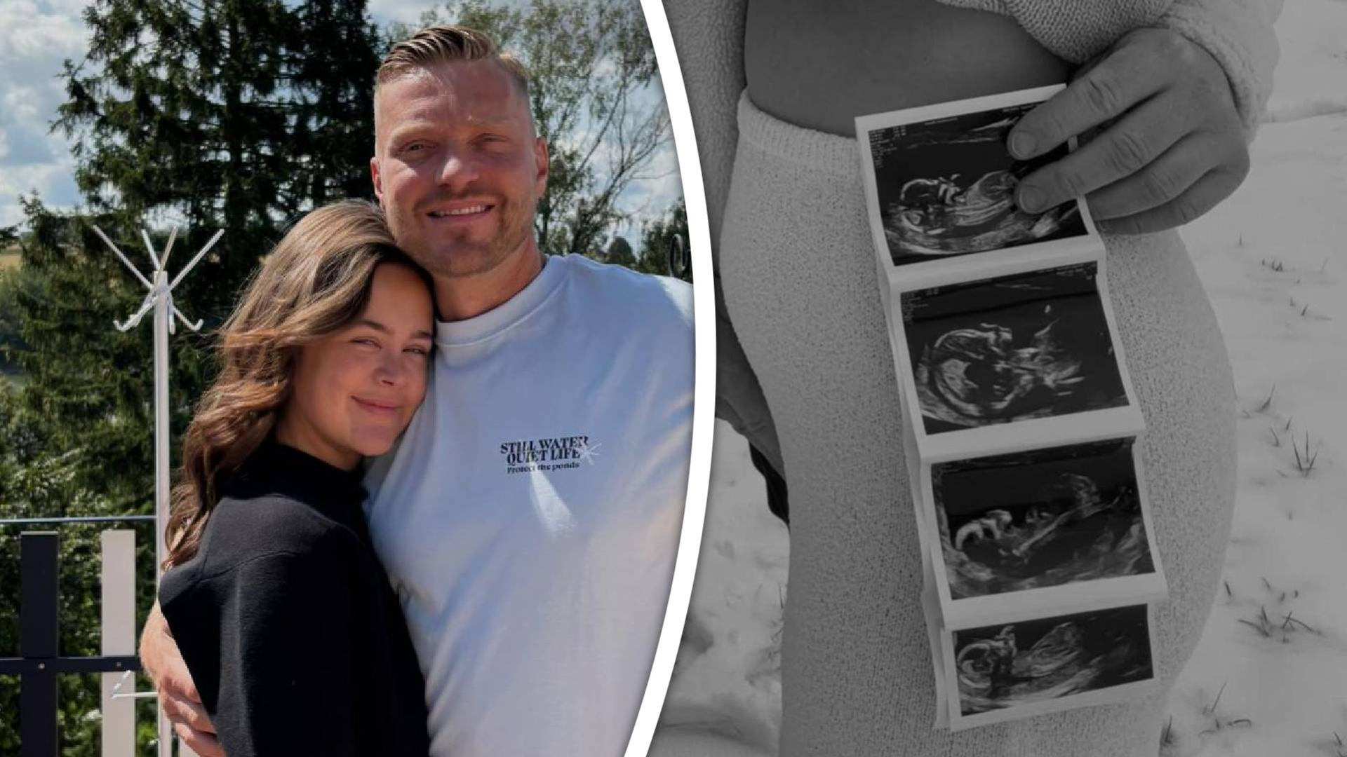 Het stel verwacht een baby.