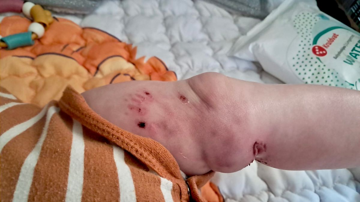 Honden weg uit Coevorder woonwijk nadat baby Hailey werd gebeten: 'Verschuiven van probleem'