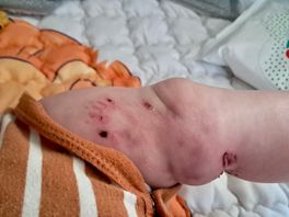 Honden weg uit Coevorder woonwijk nadat baby Hailey werd gebeten: 'Verschuiven van probleem'