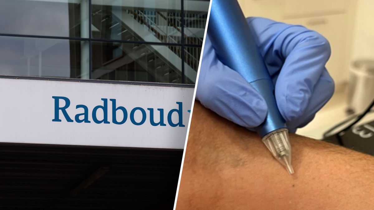 Kankerpatiënten in Nijmegen voortaan zonder tatoeagepuntjes bestraald