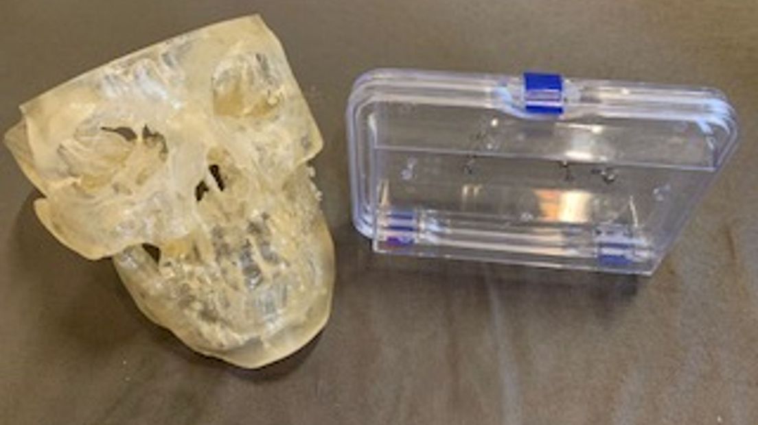 3D kaak implantaten