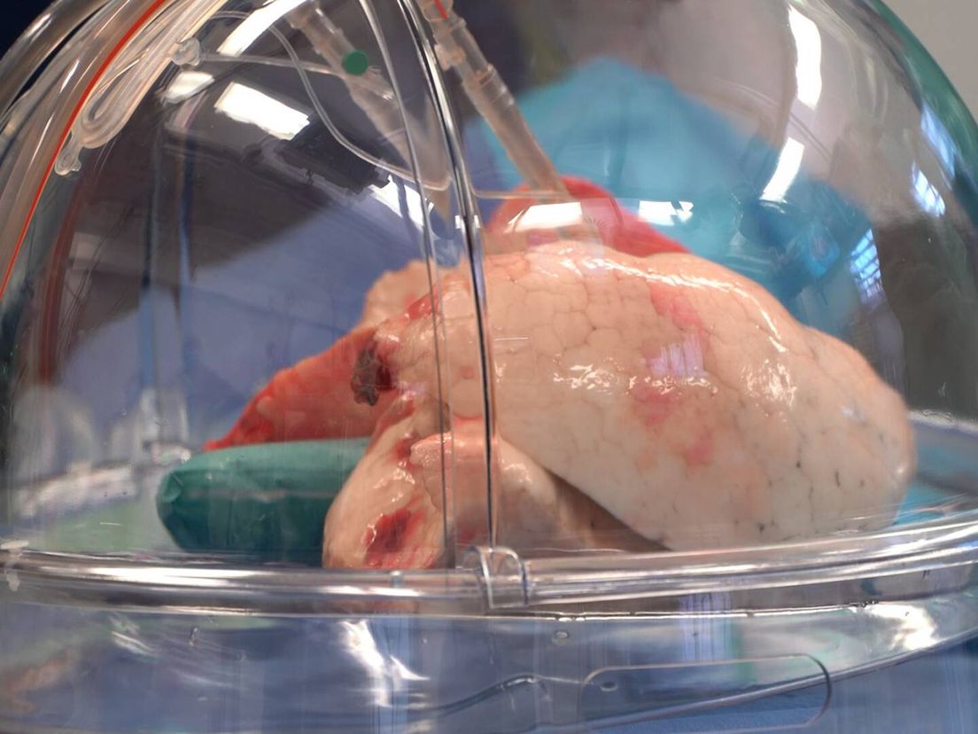 Een donorlong wordt door perfusie klaargemaakt voor een transplantatie
