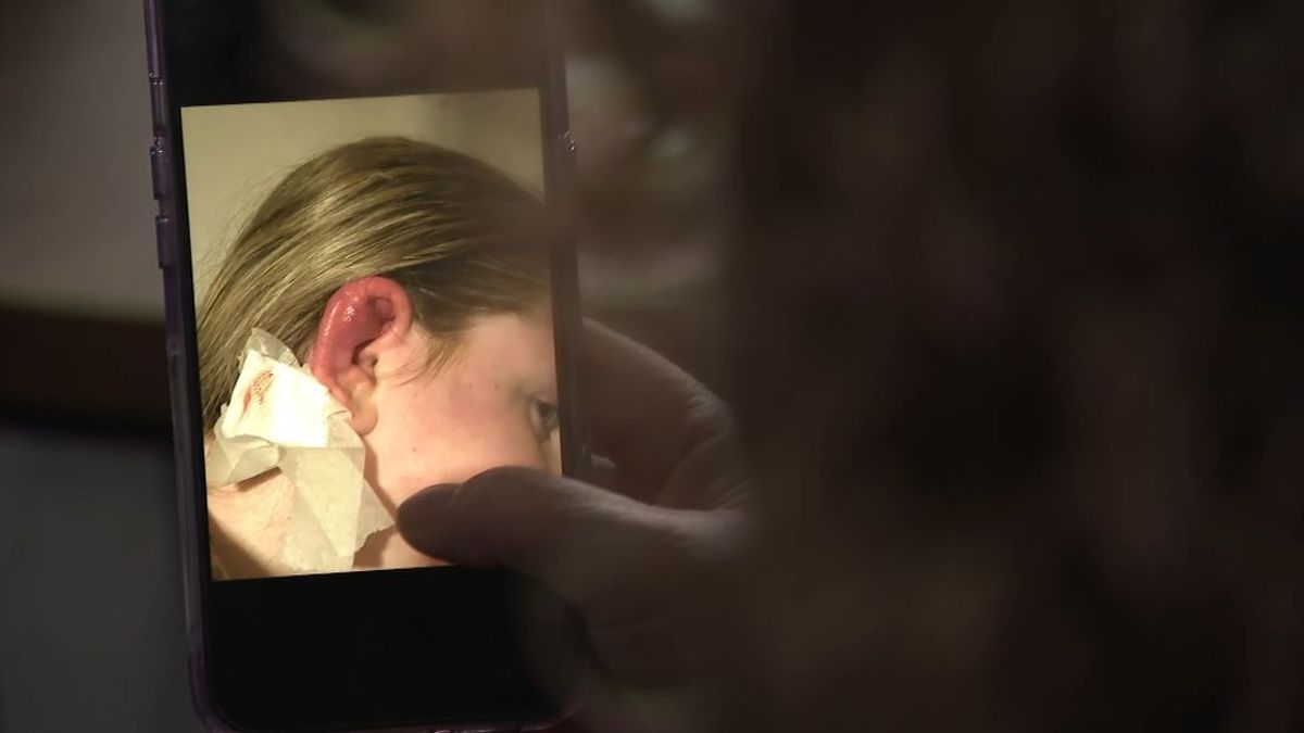 Lisa (14) uit Hardenberg belandt in ziekenhuis na bezoek aan piercingshop