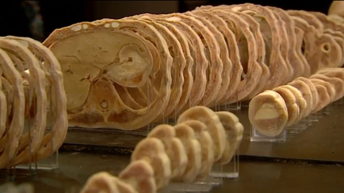 Hoe ziet het menselijk lichaam er van binnen uit? Dat is dit weekend te zien in Drachten