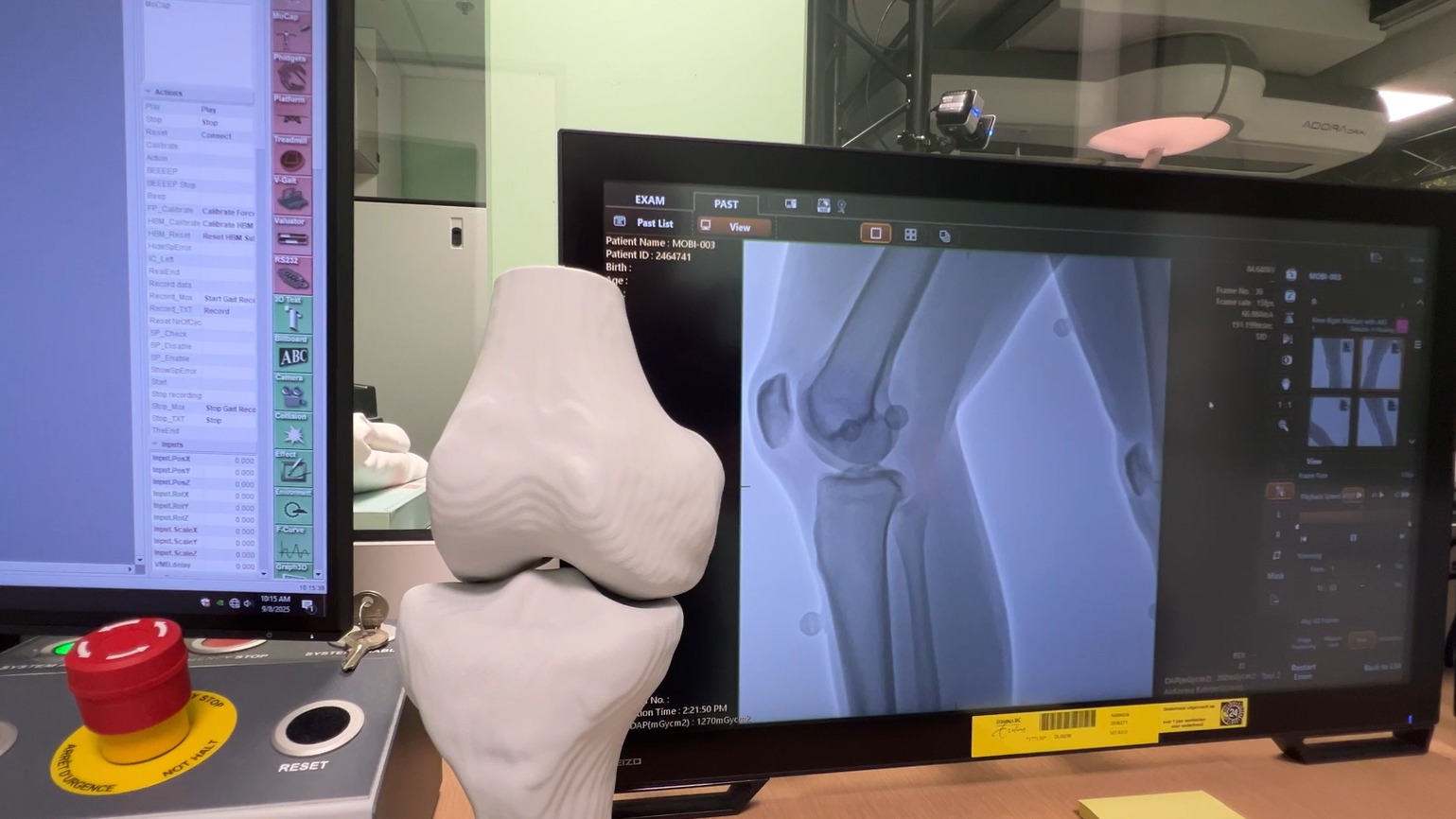 Live meekijken in de knie