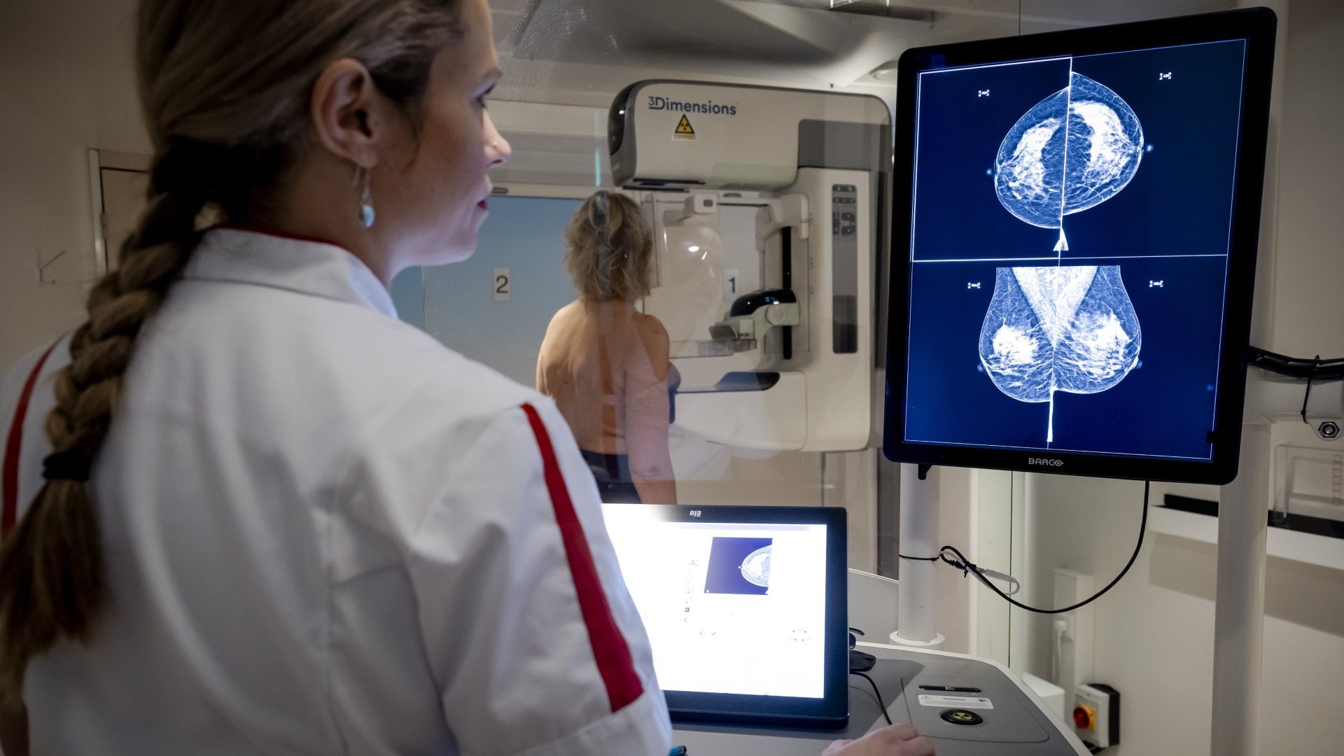 Een mammografie wordt uitgevoerd bij een vrouw (Foto: ANP)