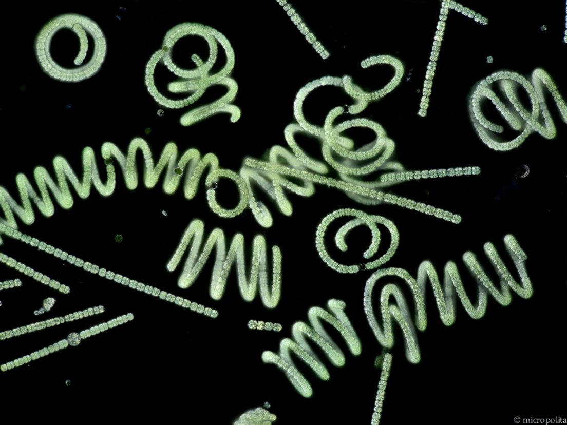 Microben foto Wim van Egmond