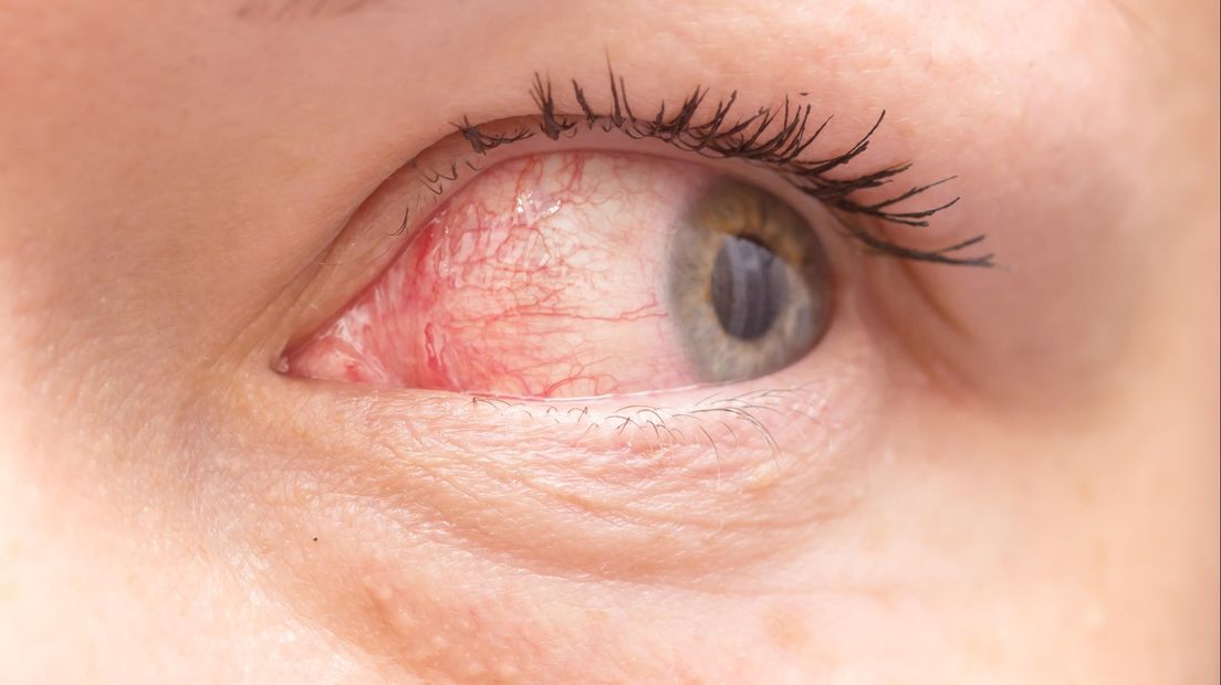Rode ogen verraden Rijssense drugsrijder