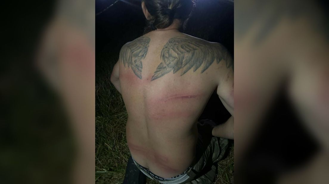 Blauwe plekken na de confrontatie met de ME in Sint-Maartensdijk