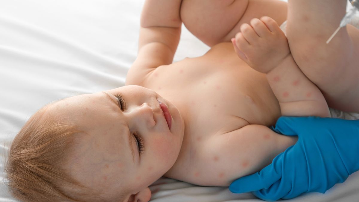 予防接種を受けていないのですか？ 託児所はどんなお子さんでも大歓迎です