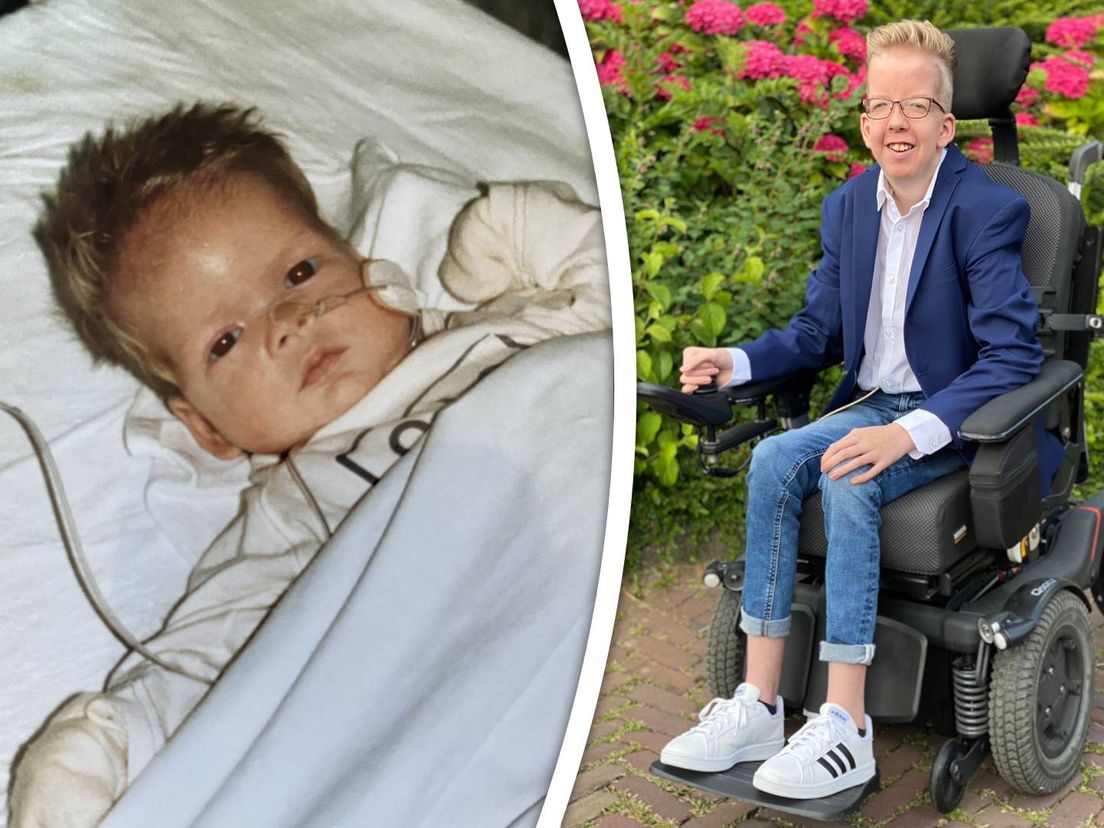 Ramon heeft sinds zijn geboorte al 44 operaties achter de rug