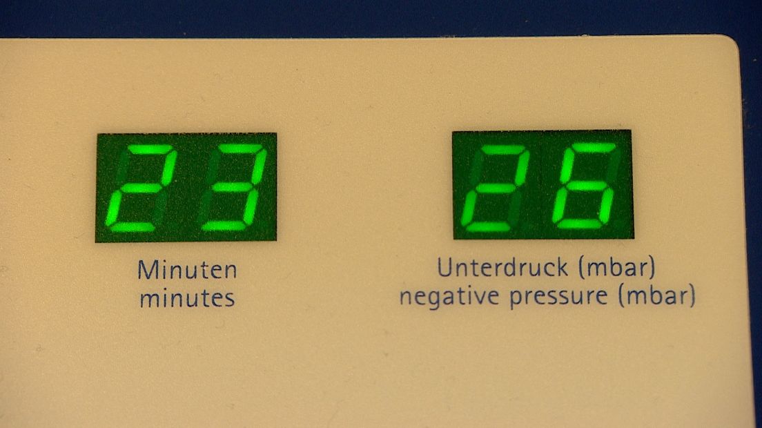 Bedieningspaneel van de vacuümtank