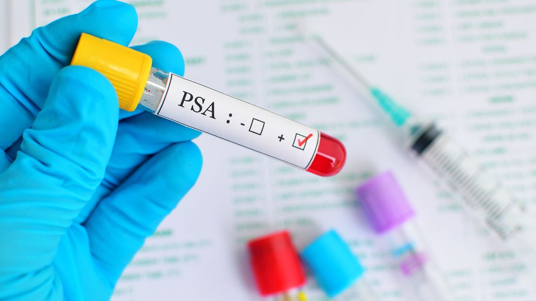 Prostaatkanker is op te sporen met een PSA-test