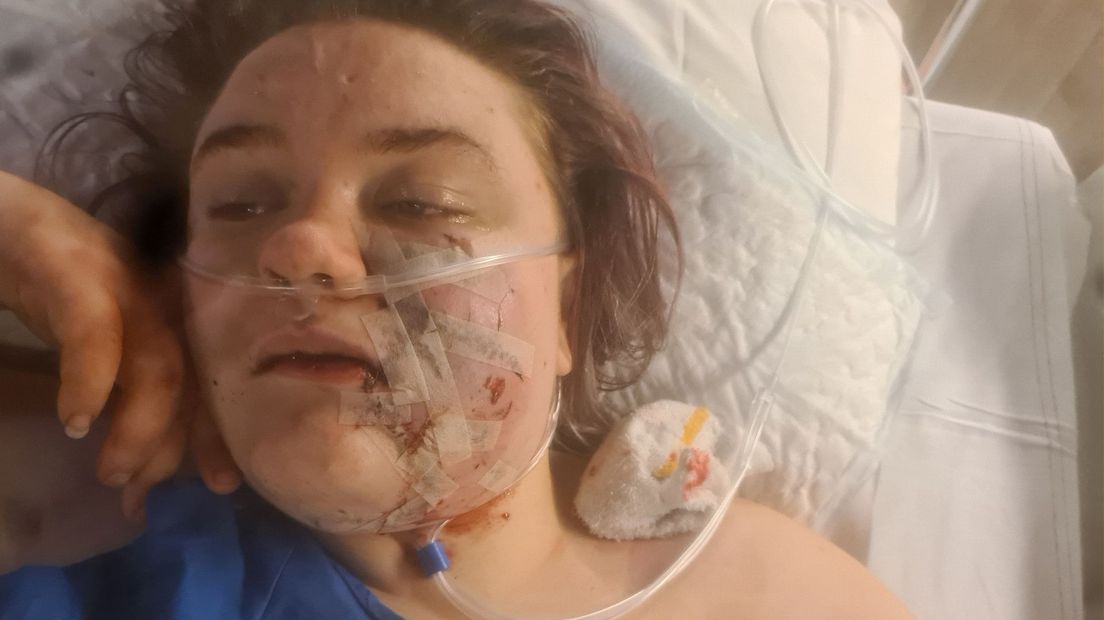 Julia werd aangevallen door een agressieve hond