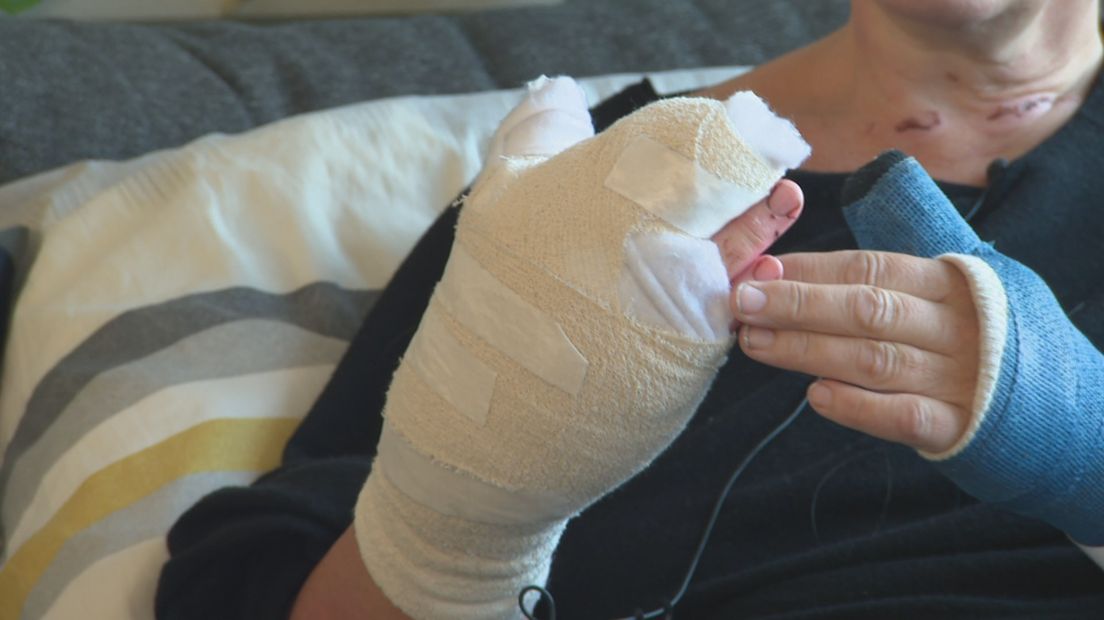 Zwolse Mirjam zwaar gewond aan haar hand door explosie