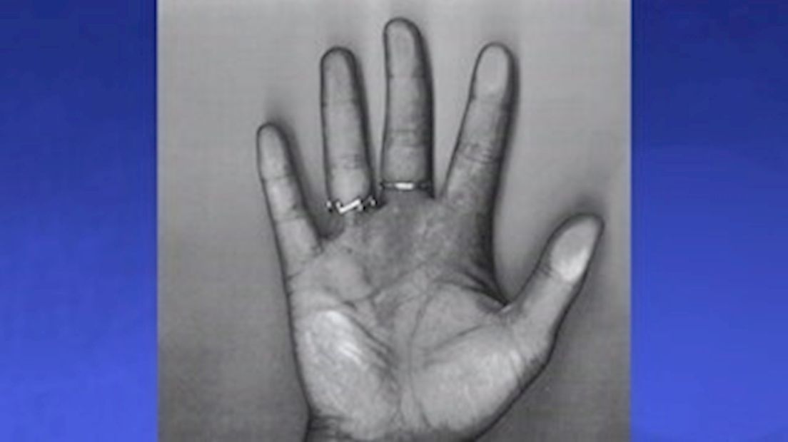 Kopie van de hand van de inbreker