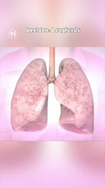 Ontwikkeling medicijn COPD