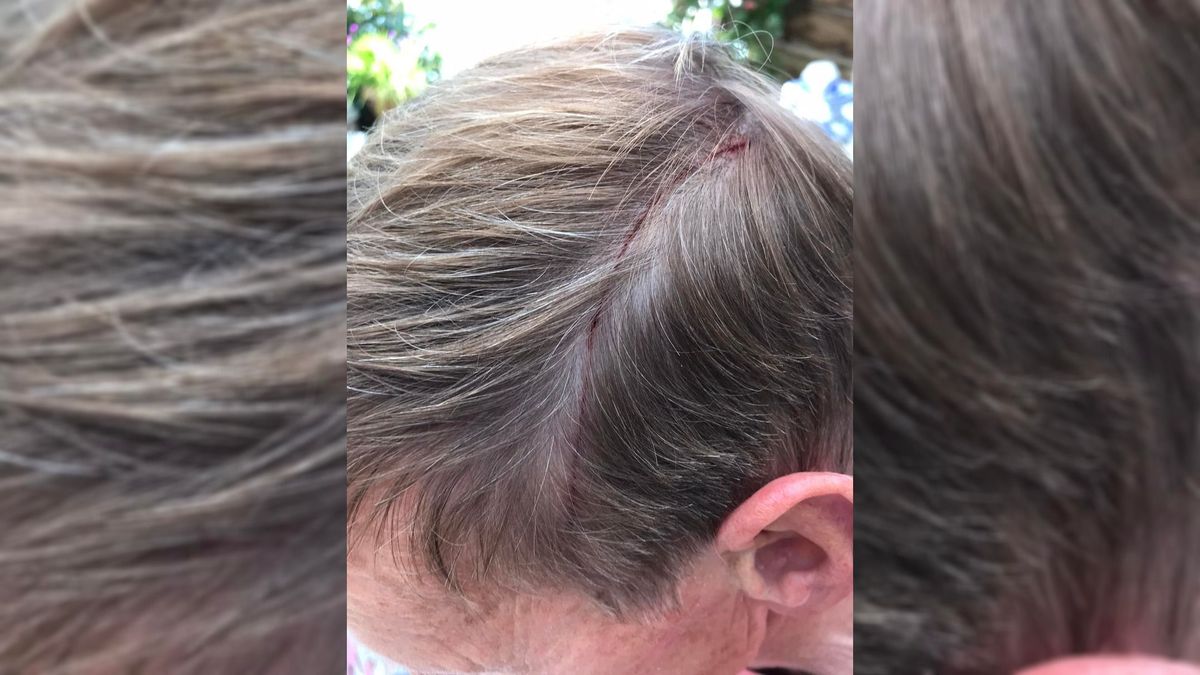 Fietsende oud-wethouder schrok zich rot, hij is aangevallen door een buizerd