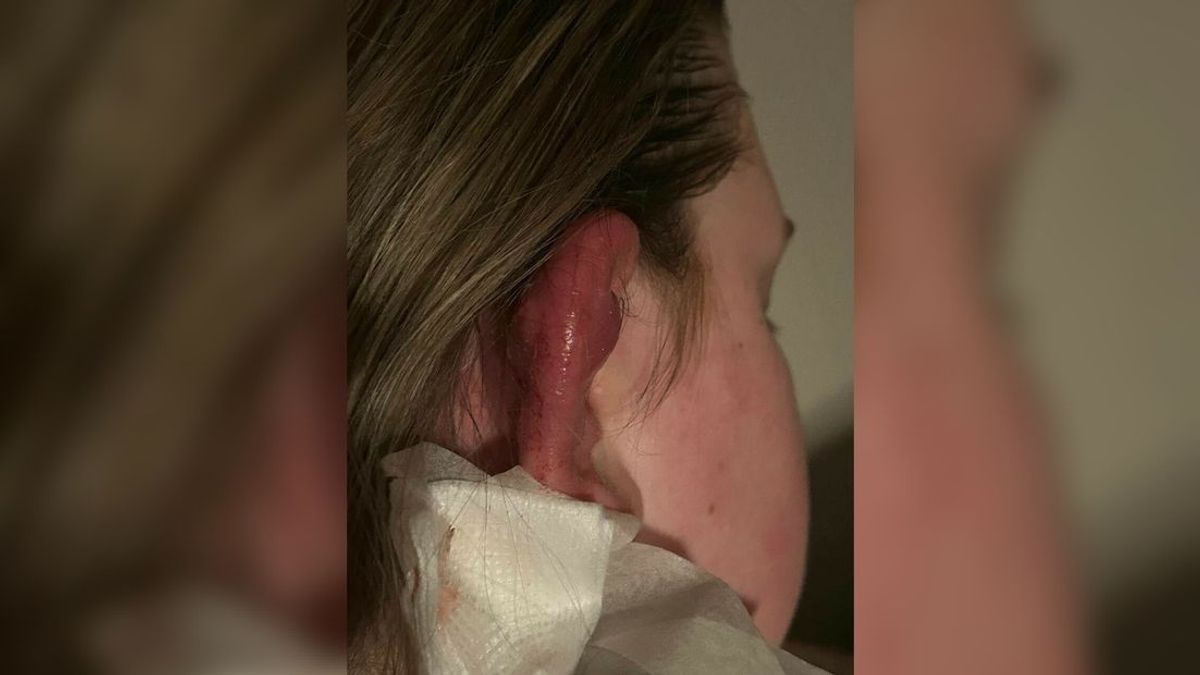 Na vele meldingen van ontstekingen sluit tattooshop in Coevorden de deuren