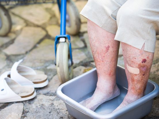 Ziekenhuizen en de hitte: hulptroepen, natte handdoeken en waterijsjes