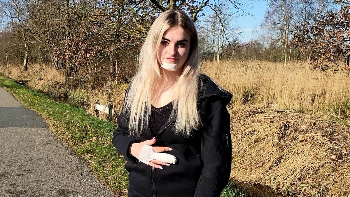 Fietsduwer bezorgde 15-jarige Jannie bij De Falom flinke verwondingen