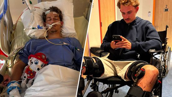 Bijna tien weken na horrorcrash verrast Levi (26) zelfs zijn artsen