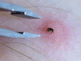 Hoe verwijder je een teek op de juiste manier? Dit moet je weten