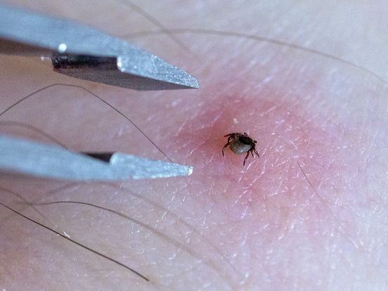 Hoe verwijder je een teek op de juiste manier? Dit moet je weten