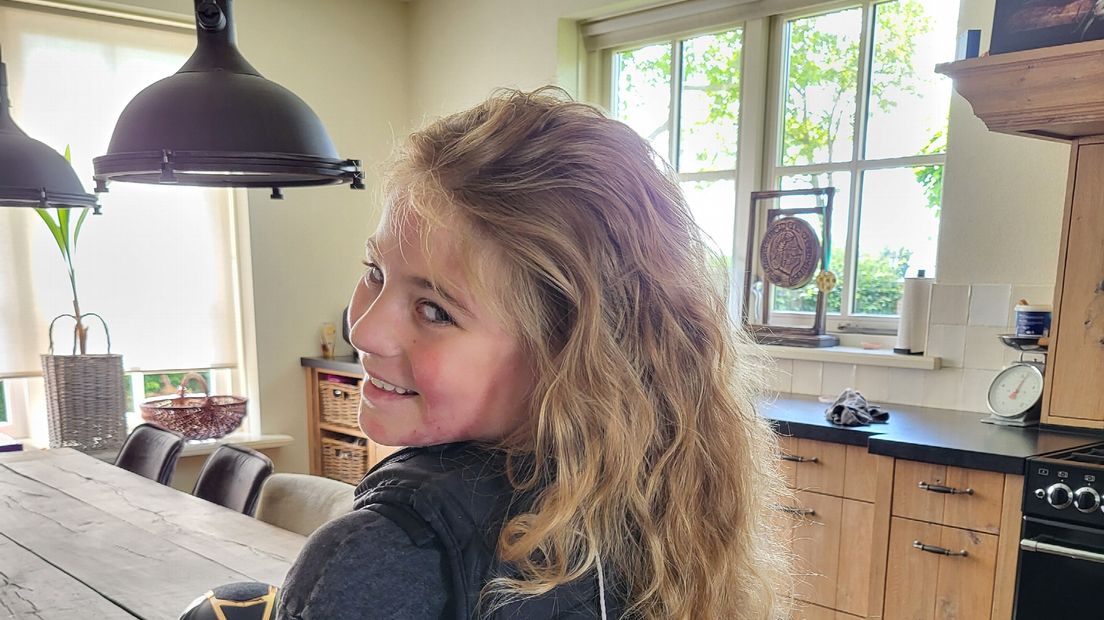 Femke Land met brandwond op haar wang