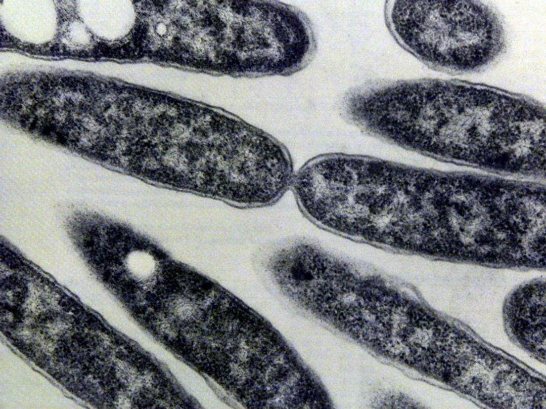 09-10-Legionella.jpg