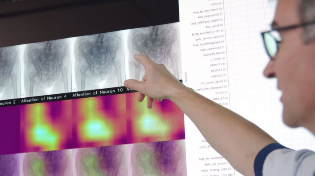 Samenwerking tussen ziekenhuizen verbetert diagnoses na bijvoorbeeld scans.